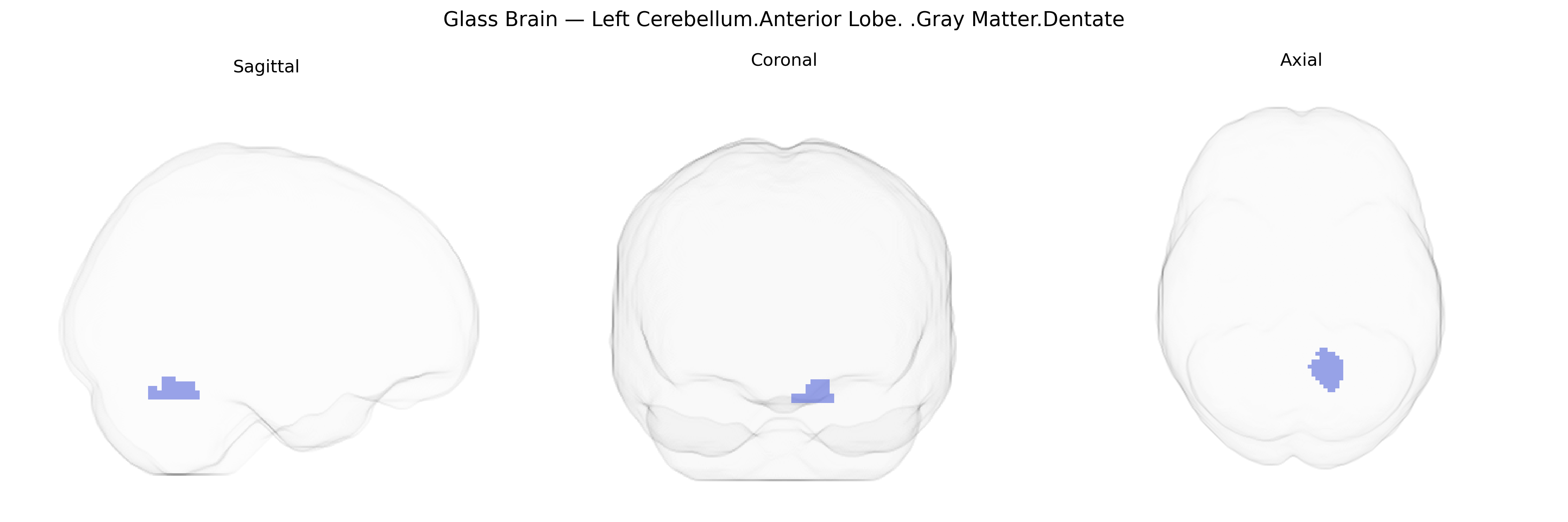 Triplanar Ghost Brain