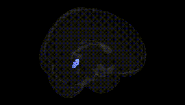 Full Brain Black