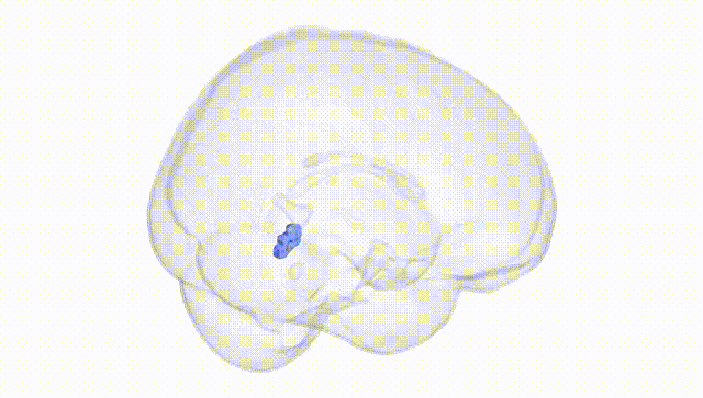 Full Brain White