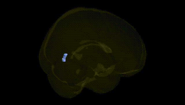 Full Brain Black