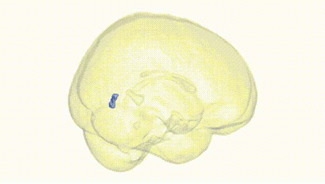 Full Brain White