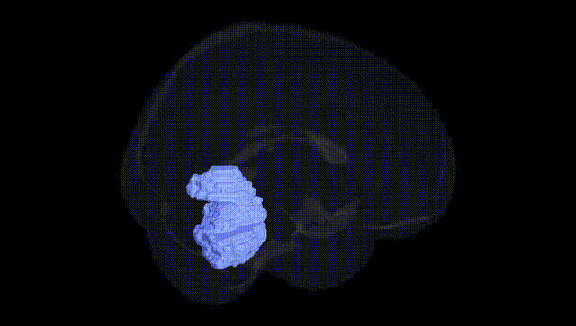 Full Brain Black