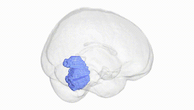 Full Brain White