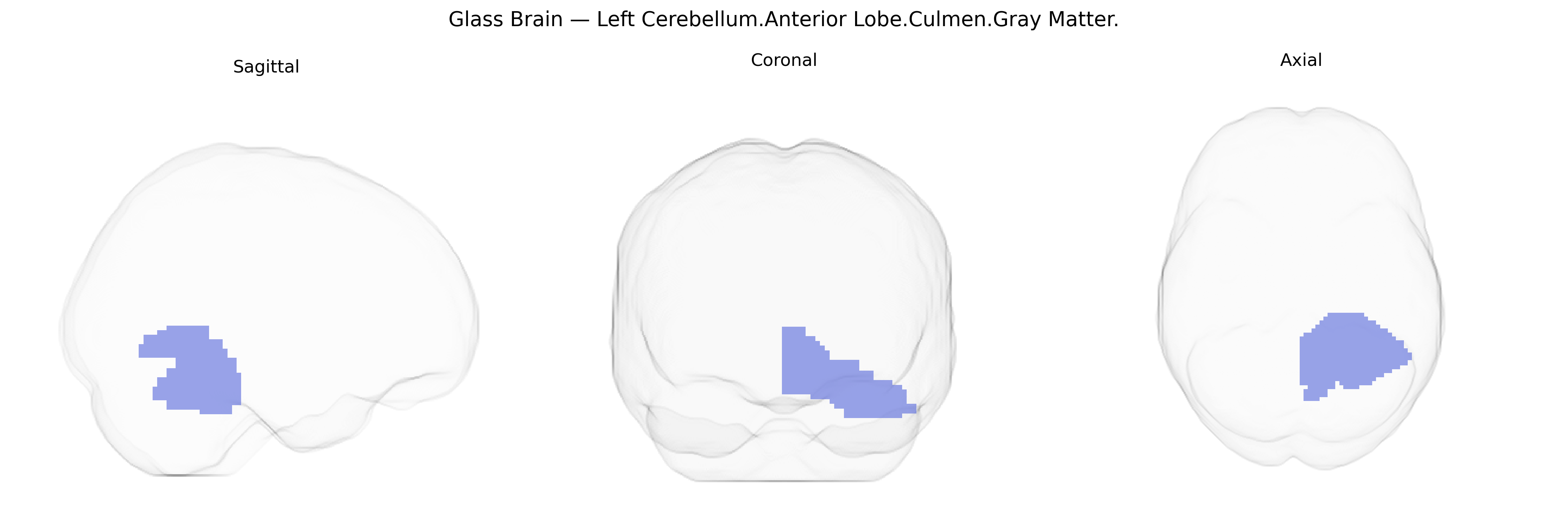 Triplanar Ghost Brain