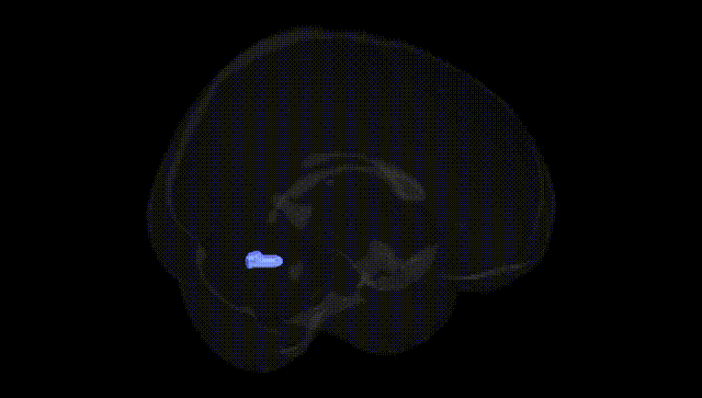 Full Brain Black