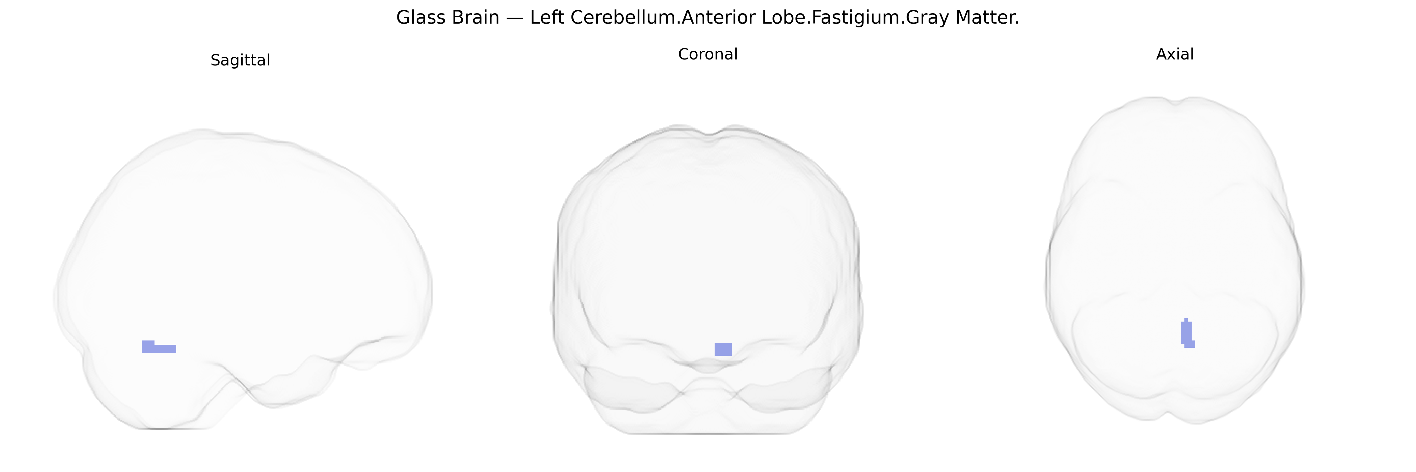 Triplanar Ghost Brain