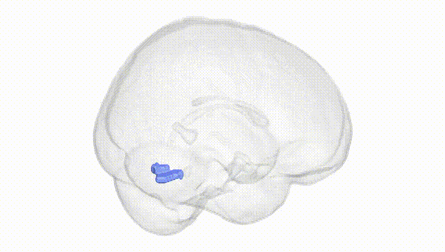 Full Brain White