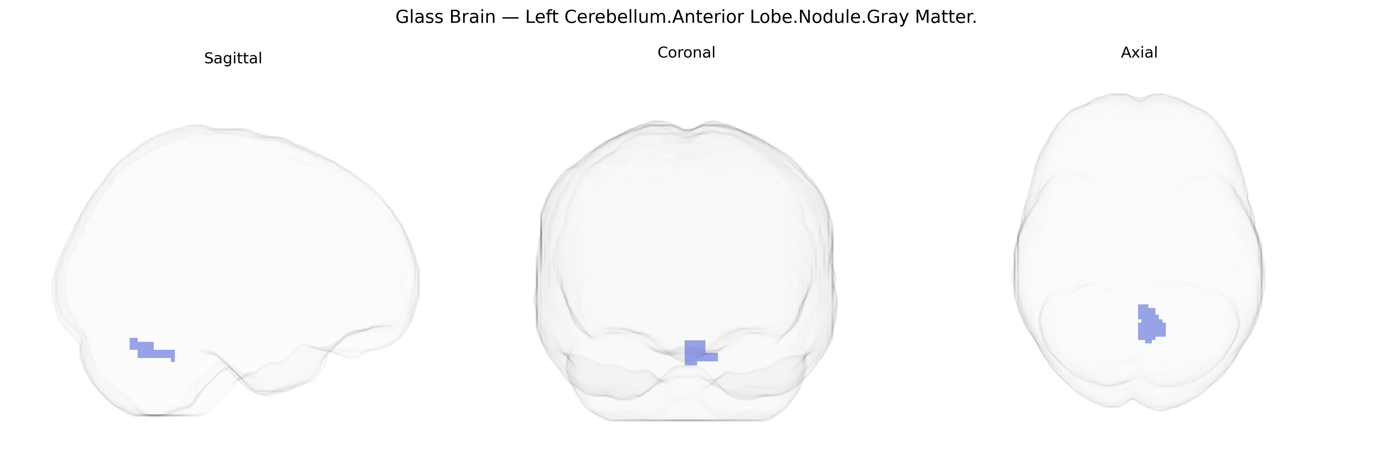 Triplanar Ghost Brain