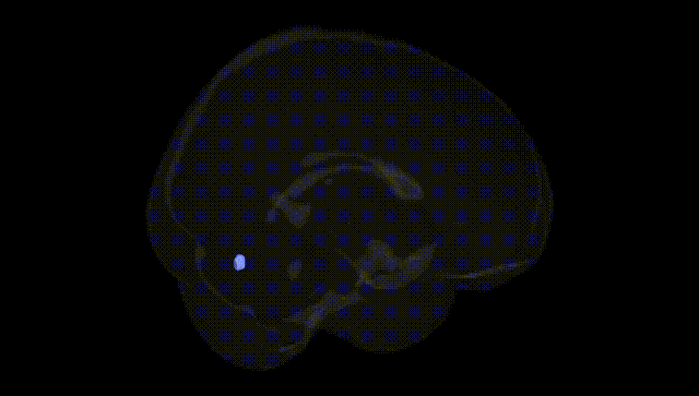 Full Brain Black