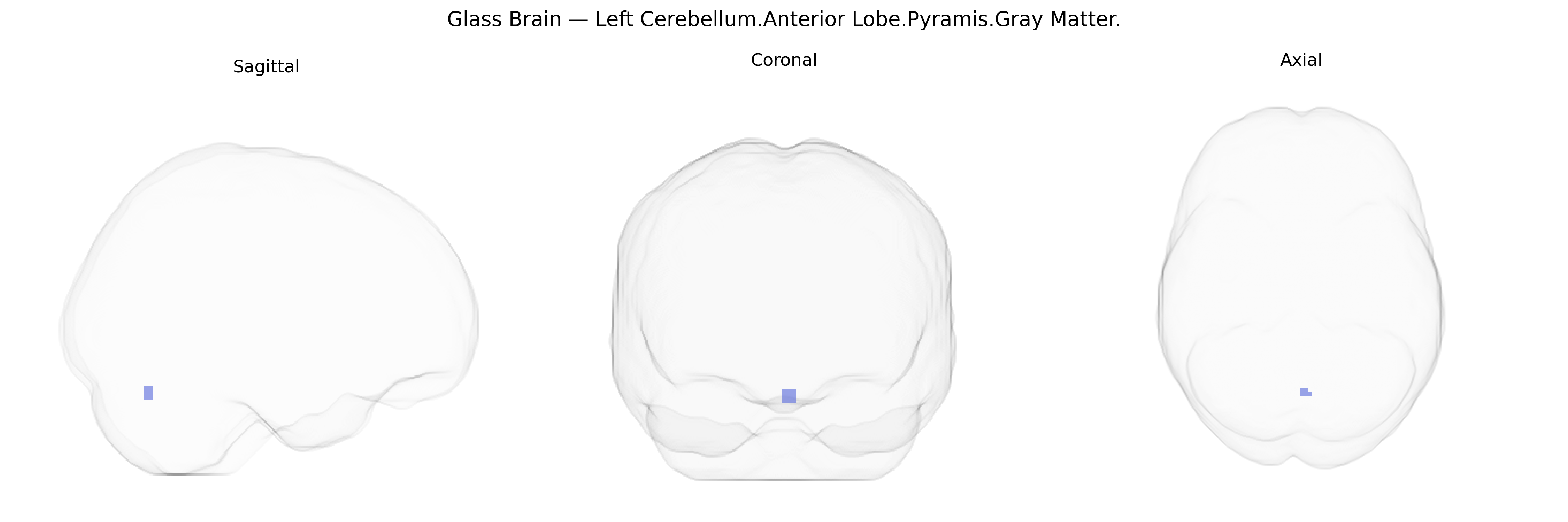 Triplanar Ghost Brain
