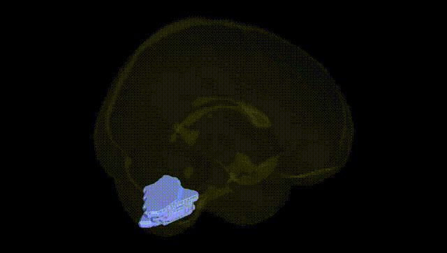 Full Brain Black