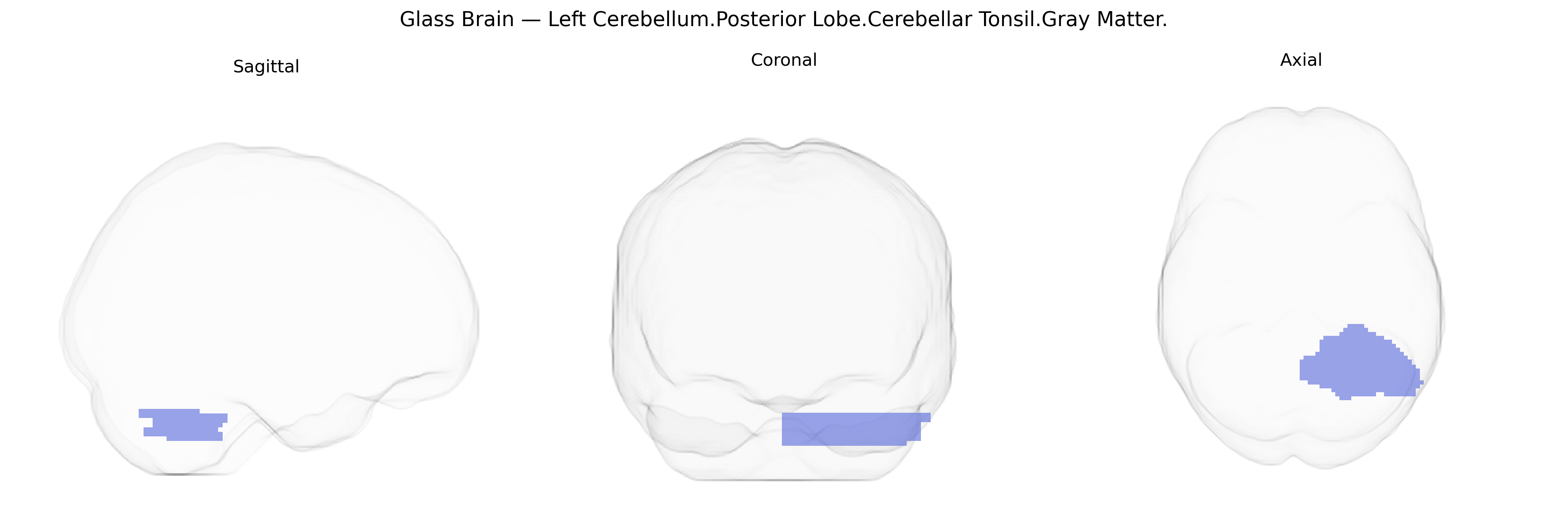Triplanar Ghost Brain
