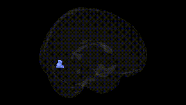 Full Brain Black