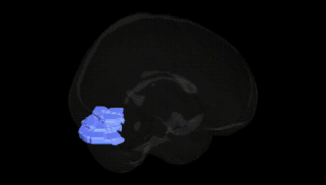 Full Brain Black