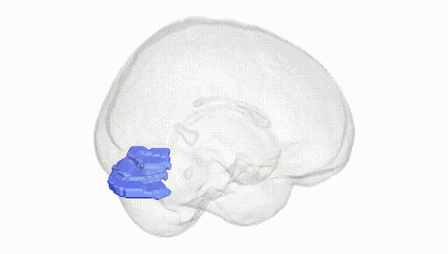 Full Brain White