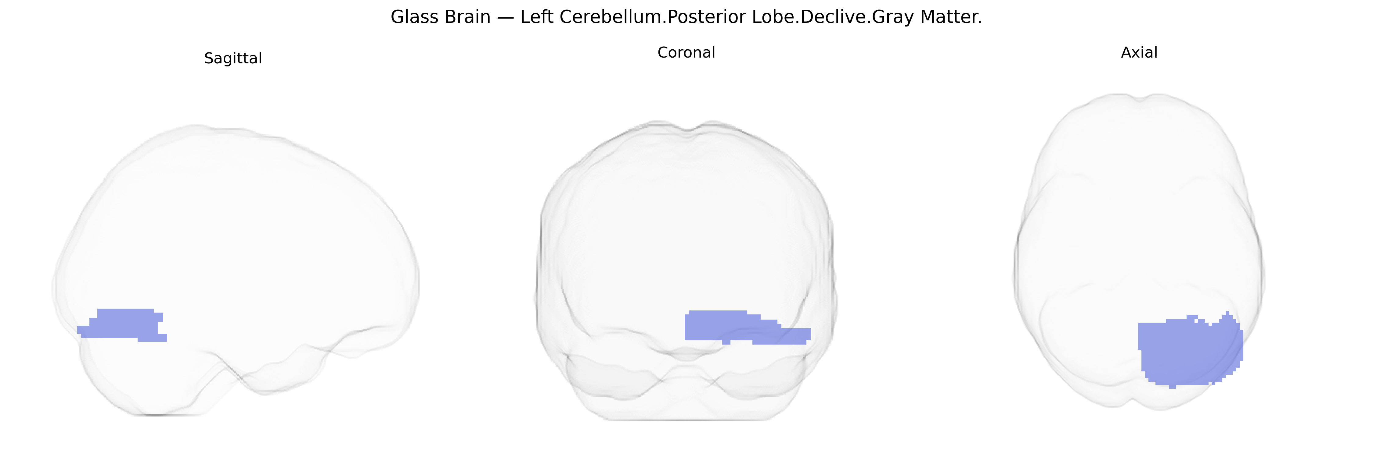 Triplanar Ghost Brain