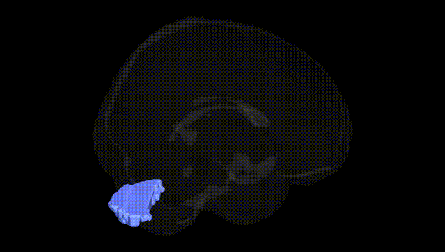 Full Brain Black