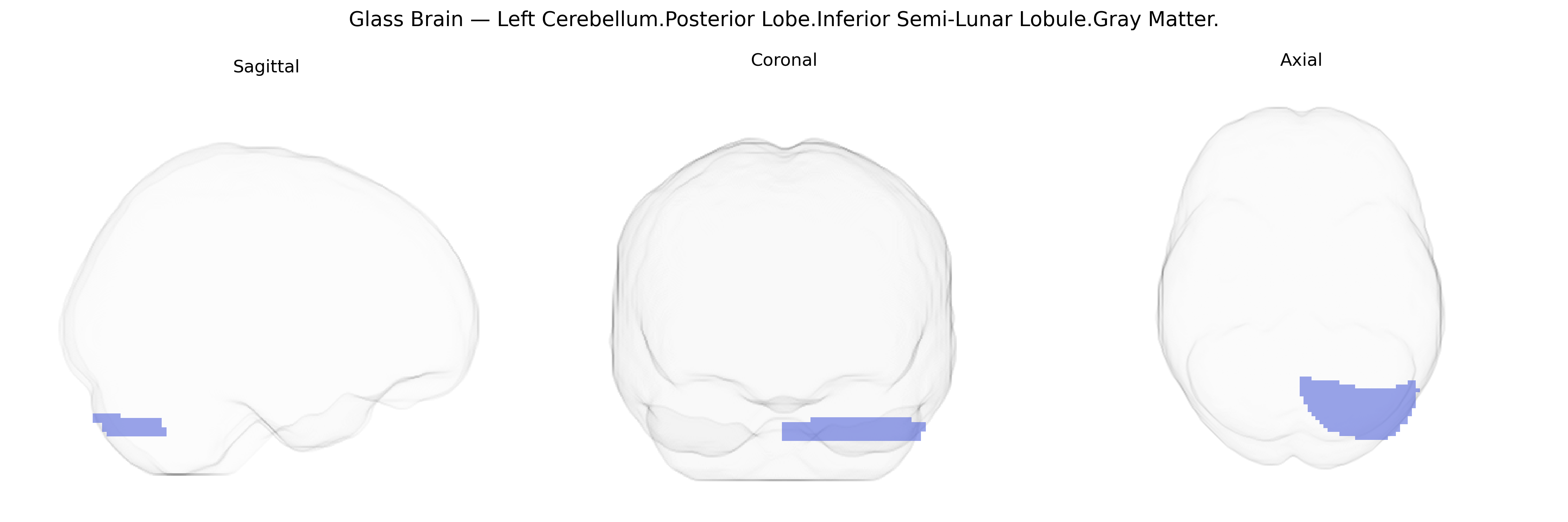 Triplanar Ghost Brain