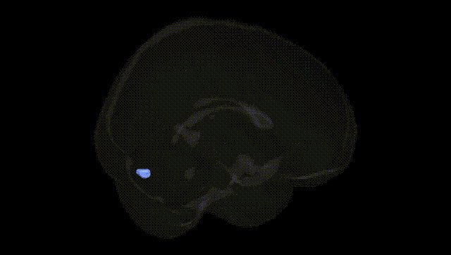 Full Brain Black