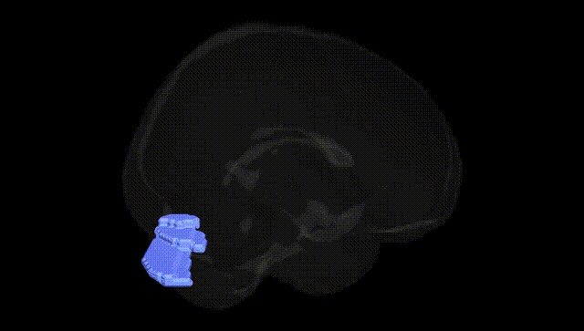 Full Brain Black