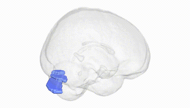 Full Brain White