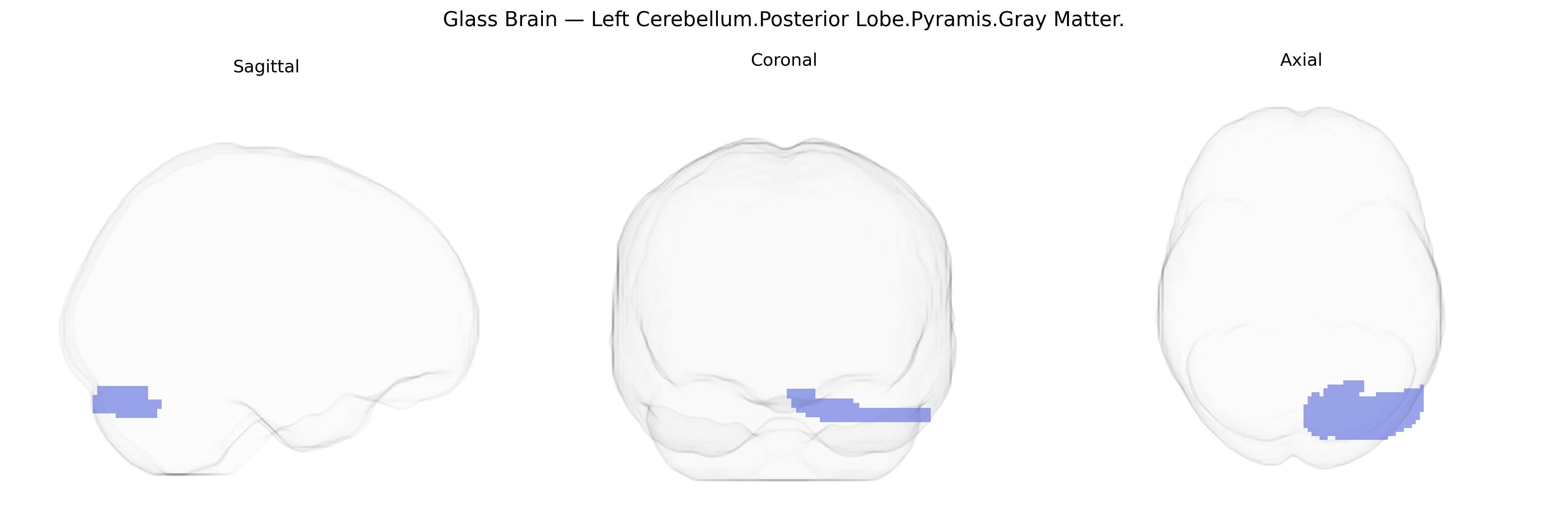 Triplanar Ghost Brain