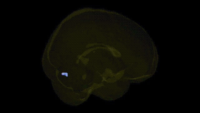 Full Brain Black