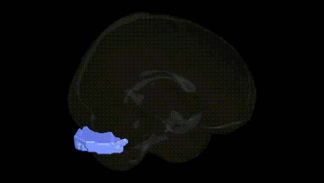 Full Brain Black