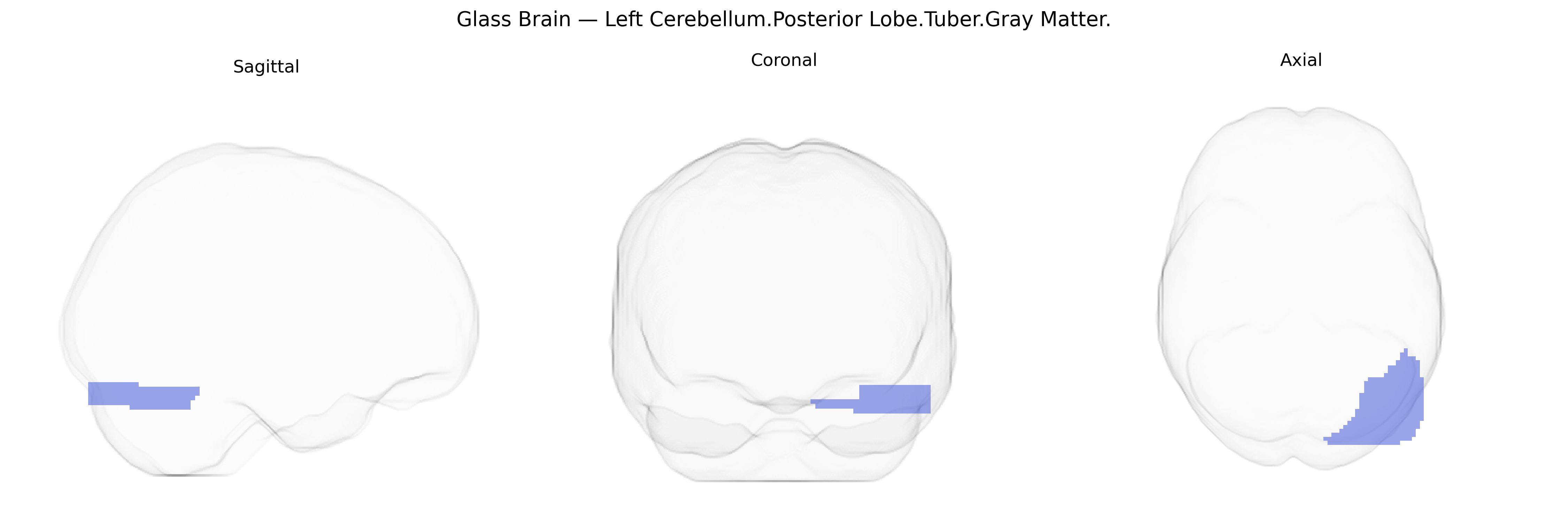 Triplanar Ghost Brain