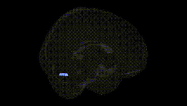 Full Brain Black