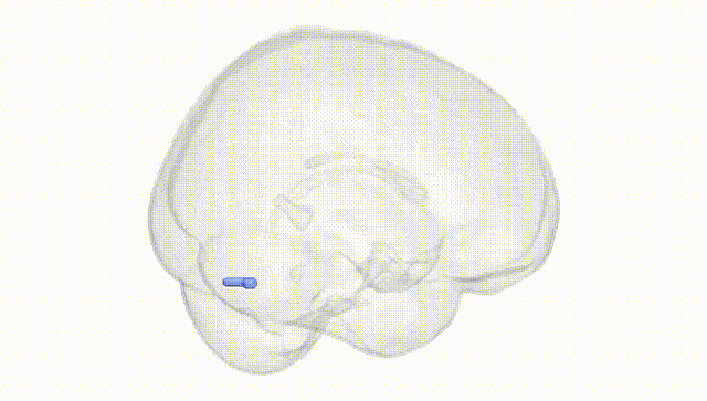 Full Brain White