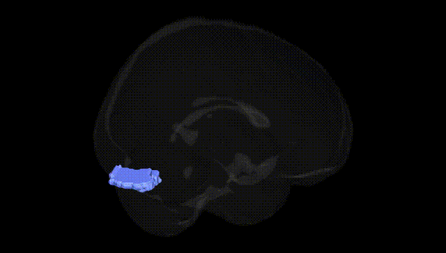 Full Brain Black