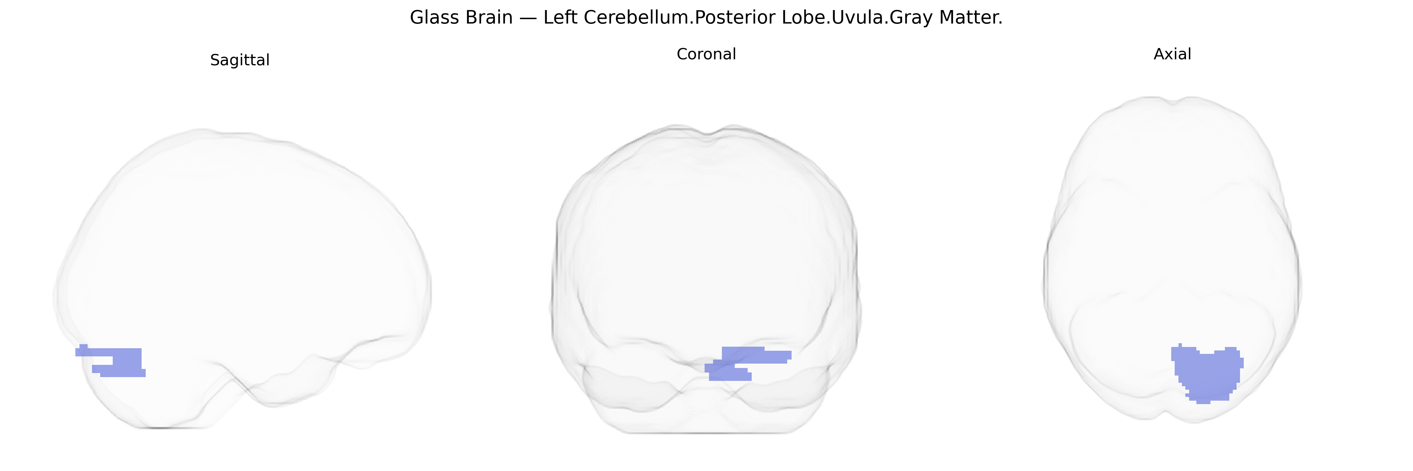 Triplanar Ghost Brain