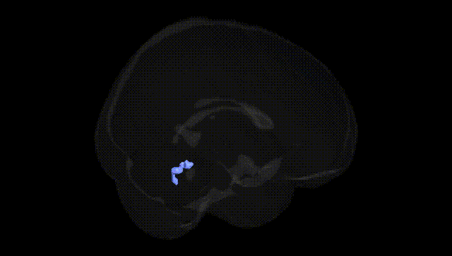 Full Brain Black