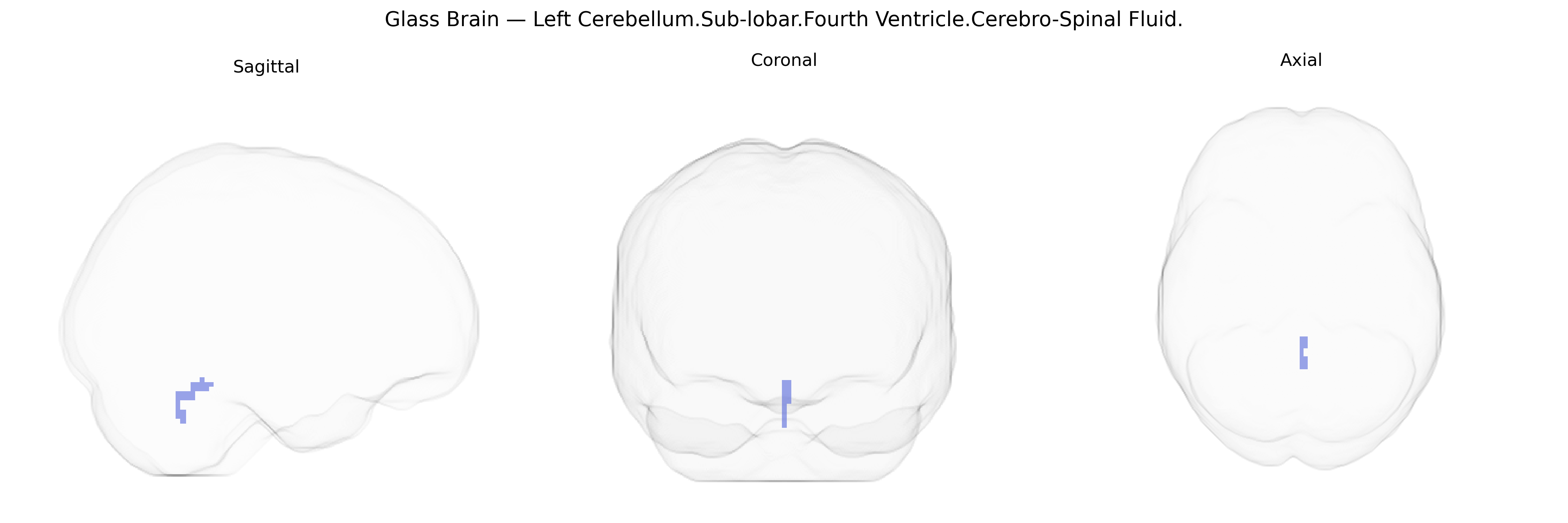 Triplanar Ghost Brain