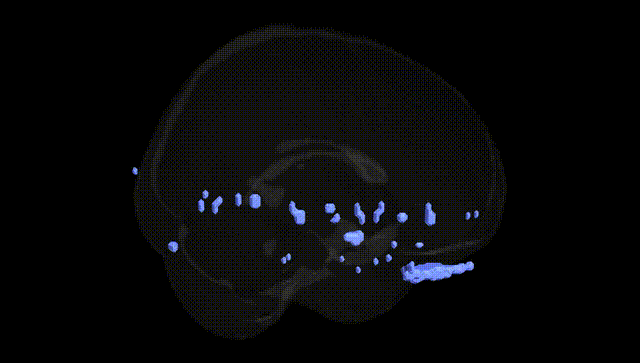 Full Brain Black