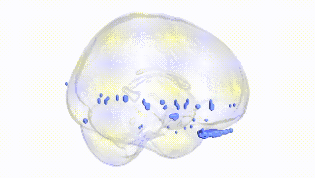 Full Brain White