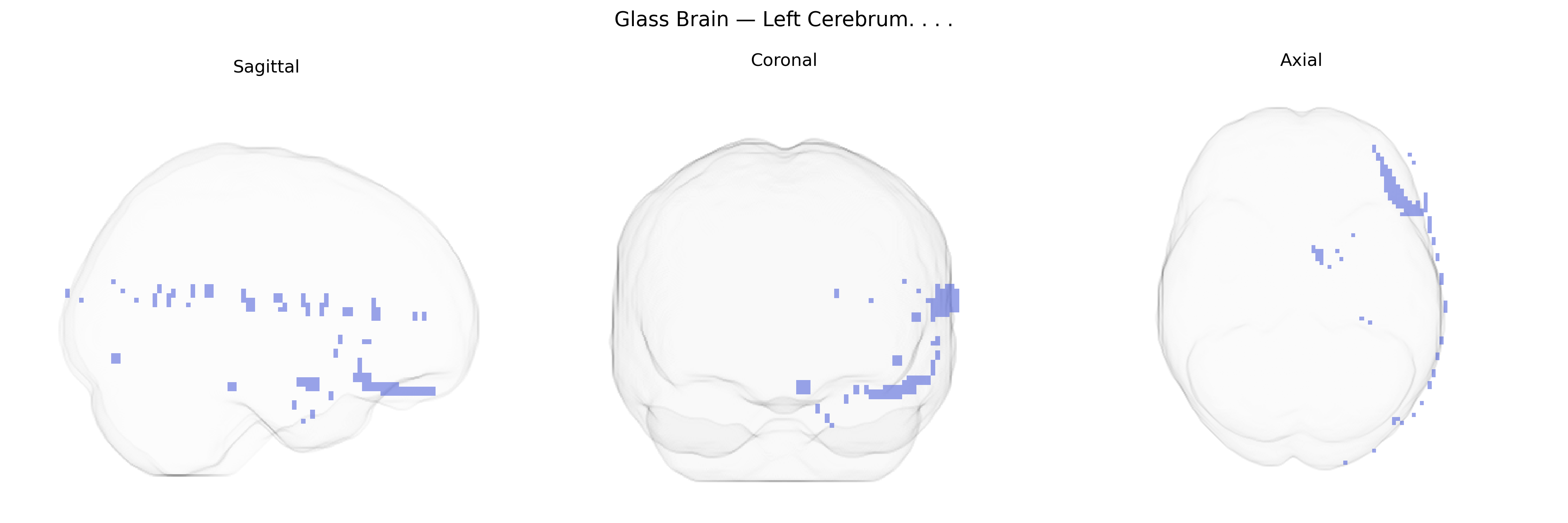 Triplanar Ghost Brain