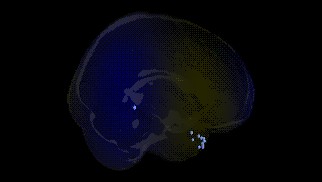Full Brain Black