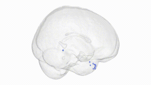 Full Brain White