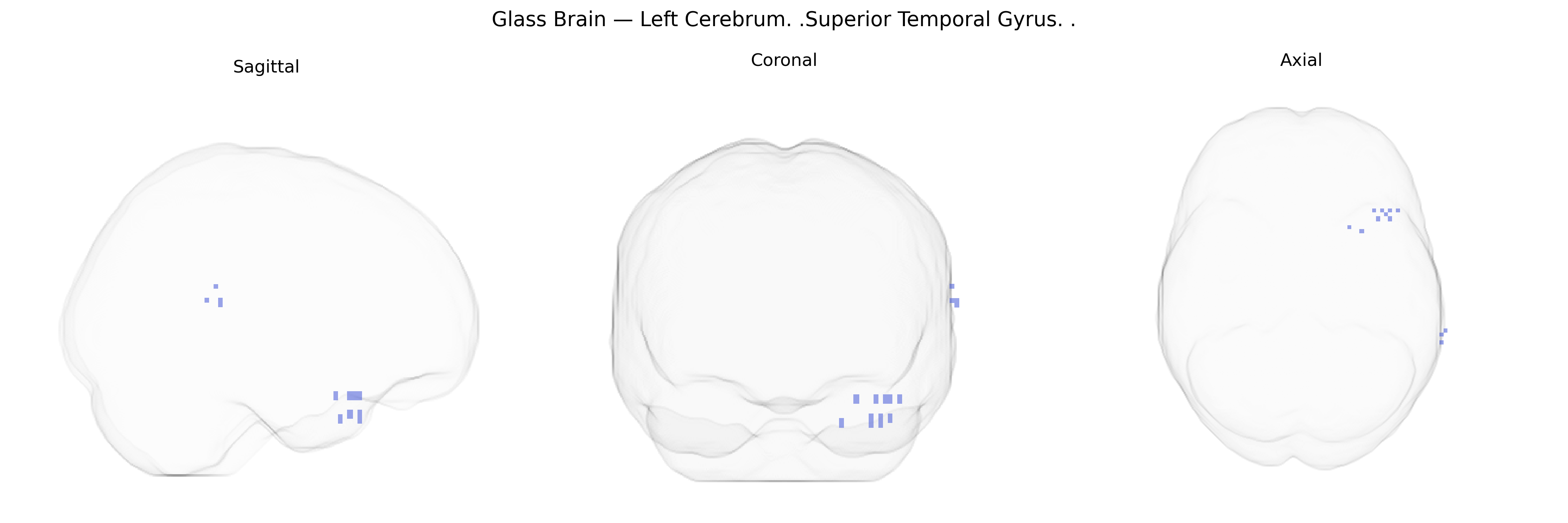 Triplanar Ghost Brain