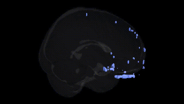 Full Brain Black