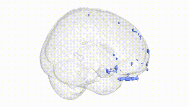 Full Brain White
