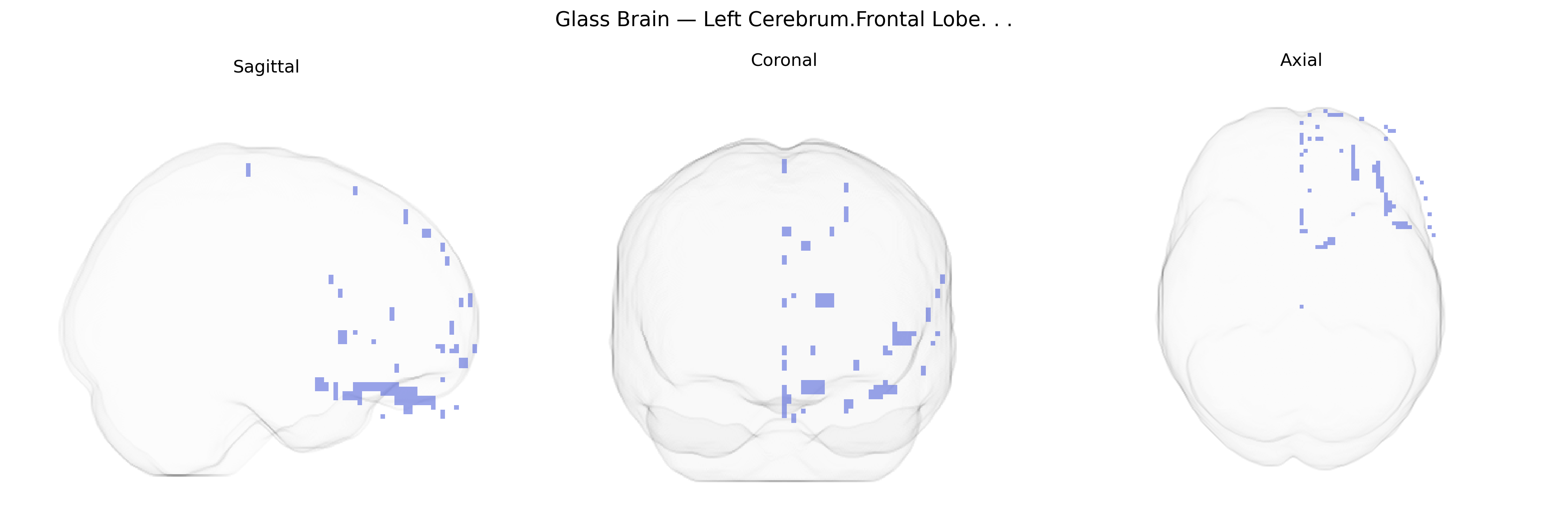 Triplanar Ghost Brain