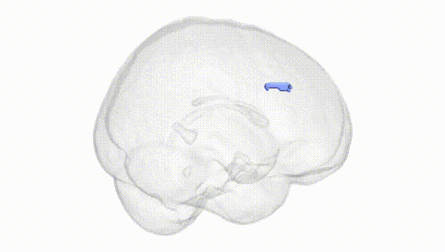 Full Brain White