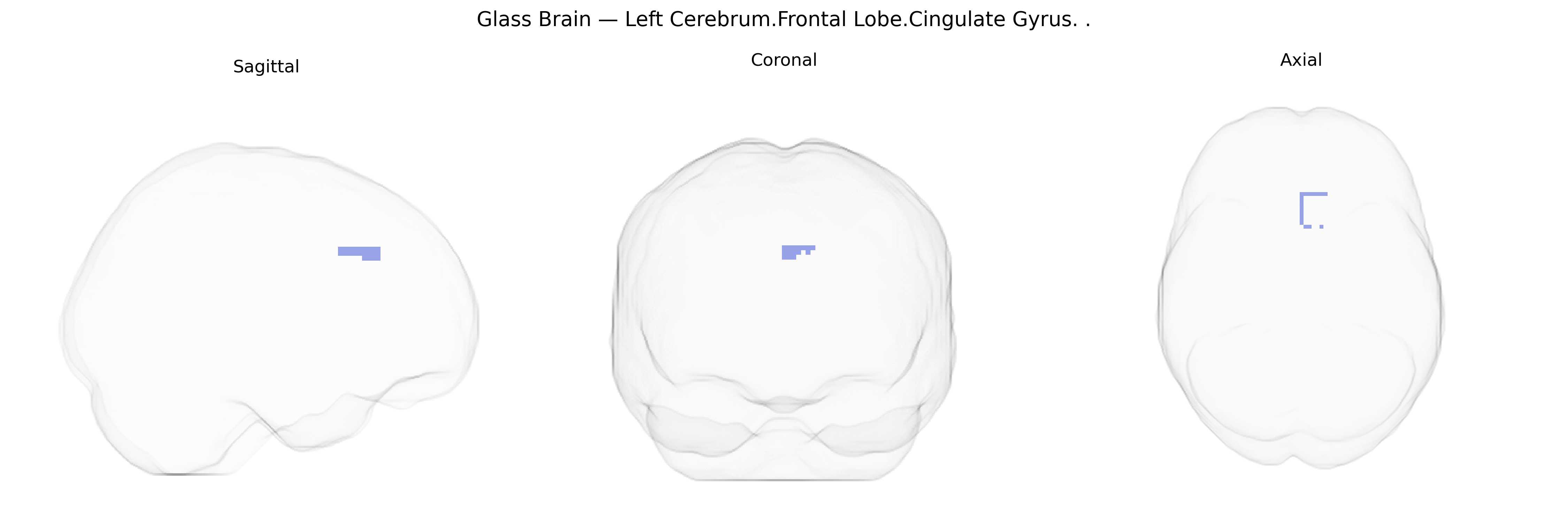 Triplanar Ghost Brain