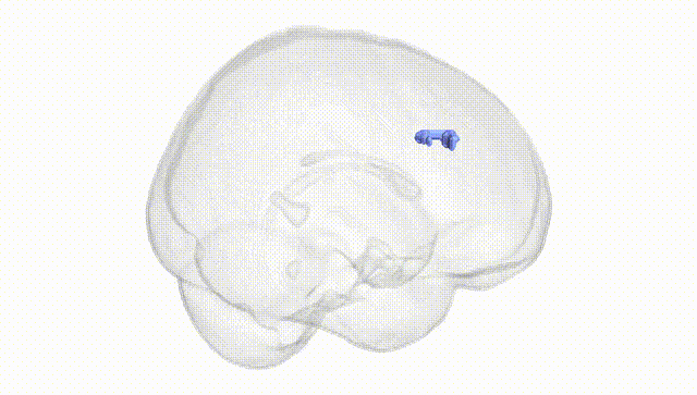 Full Brain White