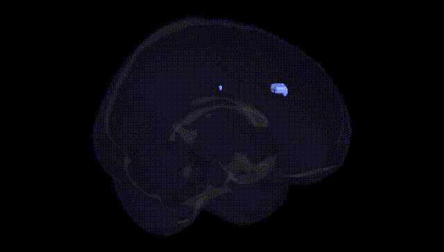 Full Brain Black