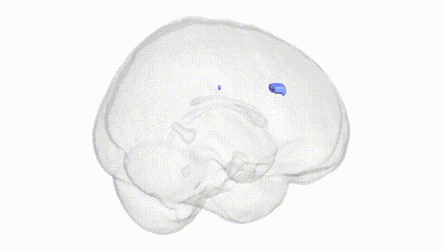 Full Brain White