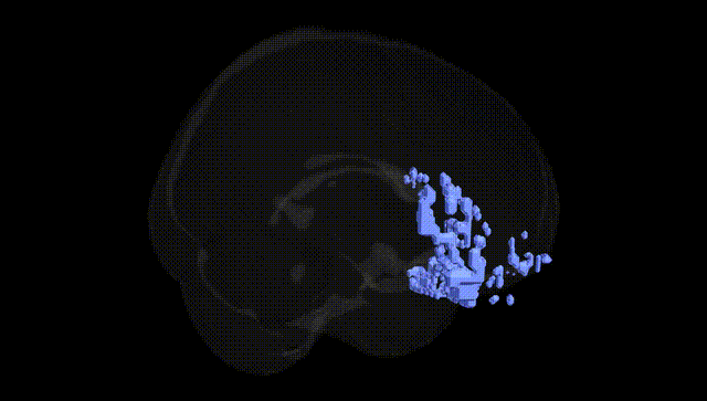 Full Brain Black